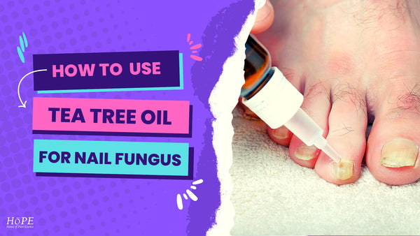 Liv Holistic (@livholistic)'s Video Of Nail Fungus Remedies, 58% OFF